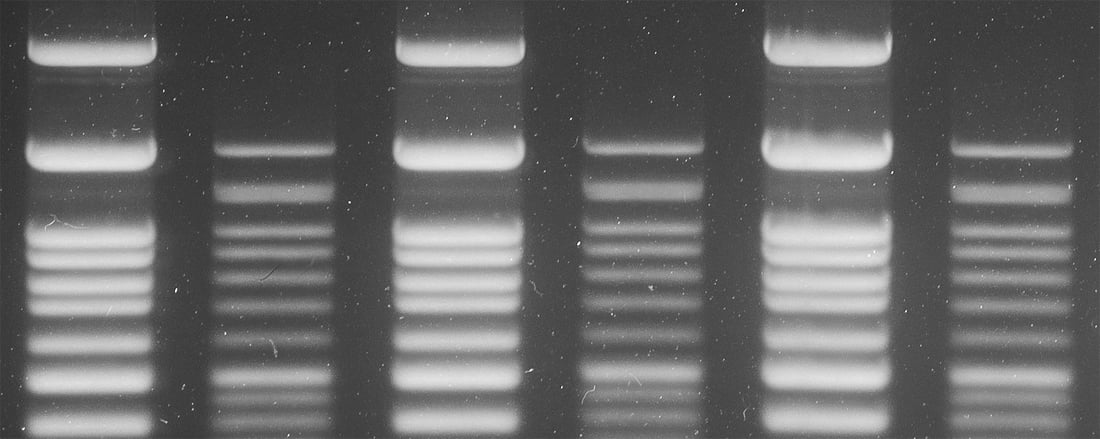 High Resolution Gel Image Example